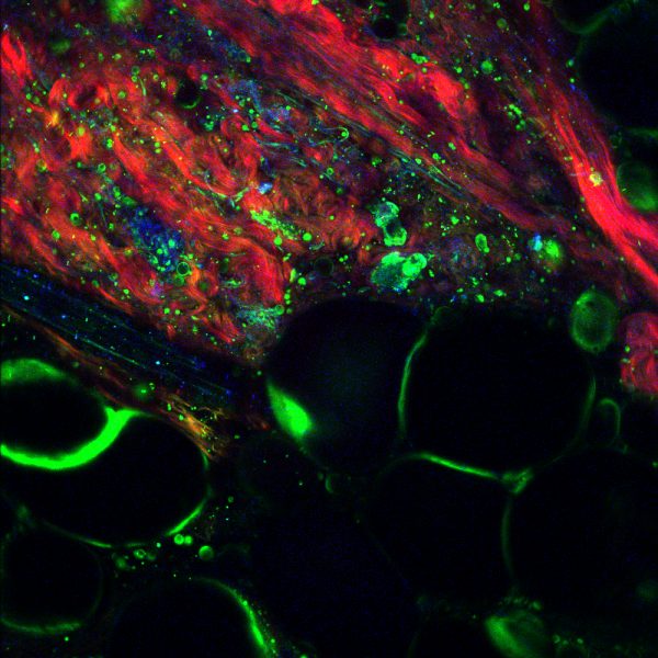 Brain tissue using femtosecond laser